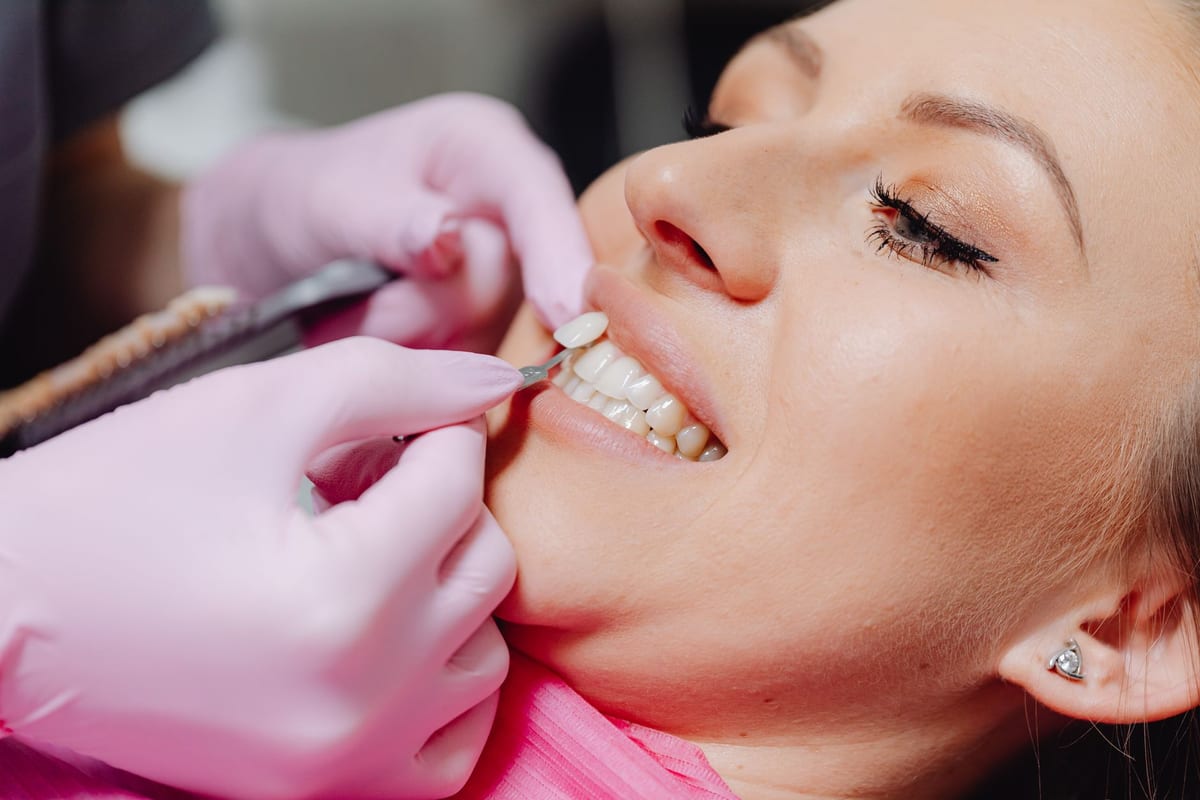 A dentist holding a veneer shade tab against a patient's upper front teeth